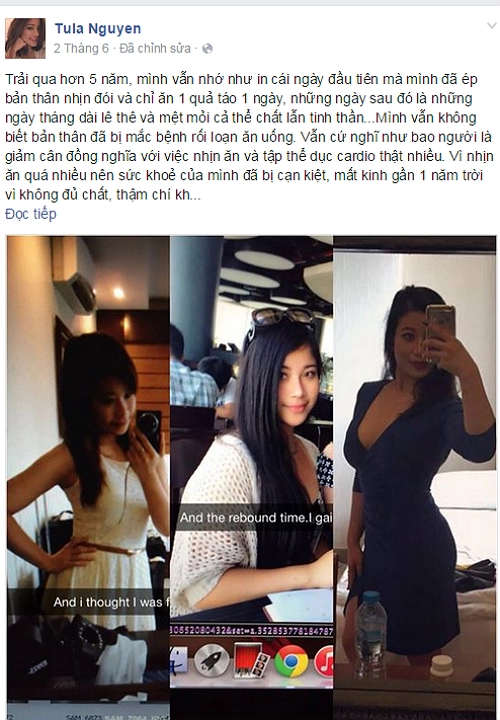 Du học sinh gợi cảm suýt vô sinh vì giảm cân kham khổ