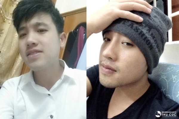 phẫu thuật thẩm mỹ không chỉ để thay đổi ngoại hình