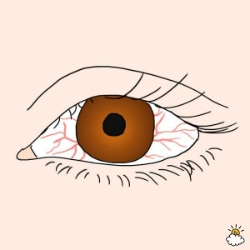 Tự chẩn đoán sức khỏe qua dấu hiệu bất thường từ đôi mắt