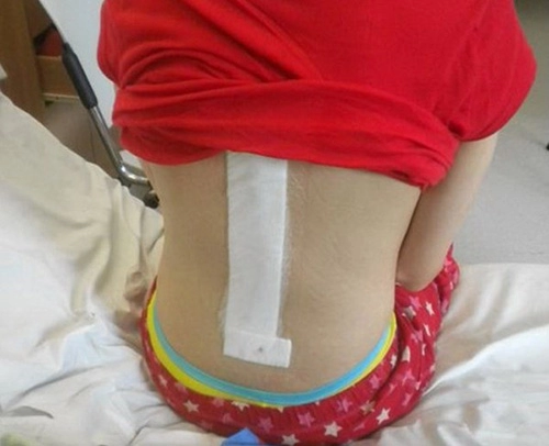 Người mẫu lưng gù xinh đẹp
