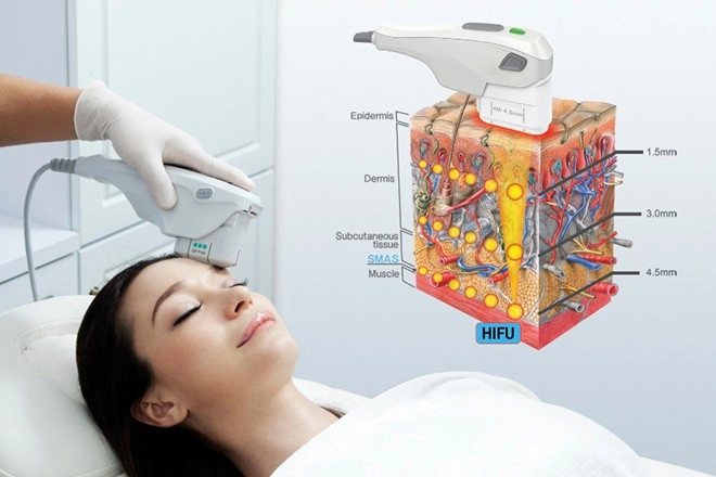 Bạn có biết phương pháp xóa nhăn nào an toàn nhất