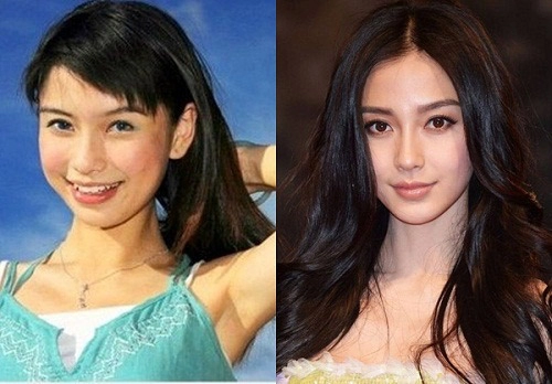 Hàng loạt sao châu á đổi vận nhờ nâng mũi