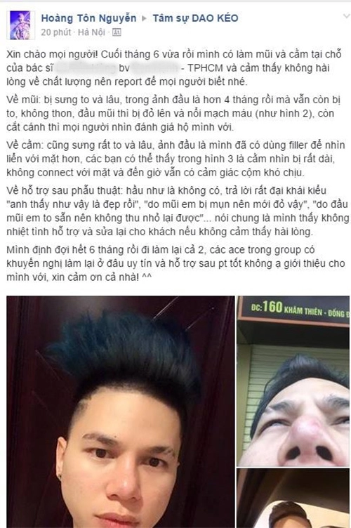 Hoàng tôn không ân hận vì phẫu thuật thẩm mỹ