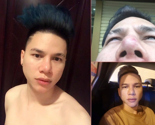 Hoàng tôn không ân hận vì phẫu thuật thẩm mỹ