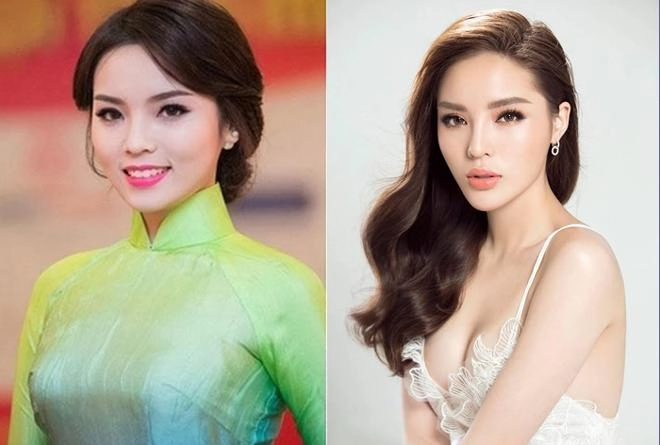 Nghi vấn độn cằm và cuộc lột xác của loạt sao