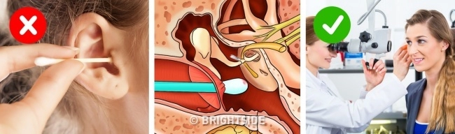Sai lầm kinh điển khi vệ sinh cá nhân