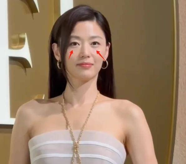 Dấu hiệu lão hóa của mợ chảnh jun ji-hyun